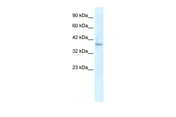 KLHL14 Rabbit Polyclonal Antibody