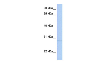 RNF41 Rabbit Polyclonal Antibody