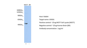 GREB1 Rabbit Polyclonal Antibody