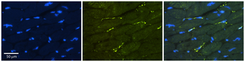 GREB1 Rabbit Polyclonal Antibody