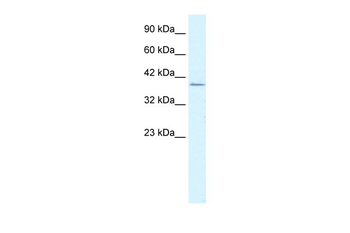 RIMS3 Rabbit Polyclonal Antibody
