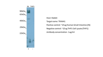 TRIM41 Rabbit Polyclonal Antibody