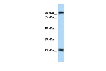 Uhrf2 Rabbit Polyclonal Antibody