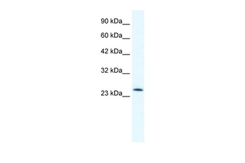 TCF7 Rabbit Polyclonal Antibody