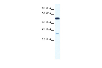 TCF7 Rabbit Polyclonal Antibody