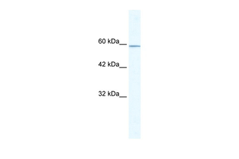 KLHL5 Rabbit Polyclonal Antibody