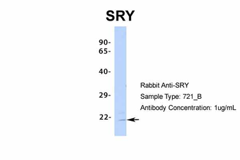 SRY Rabbit Polyclonal Antibody