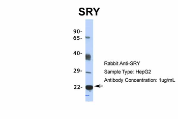 SRY Rabbit Polyclonal Antibody