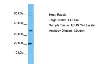 C1ORF61 Rabbit Polyclonal Antibody
