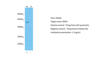 BRD9 Rabbit Polyclonal Antibody