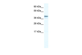 ZNF627 Rabbit Polyclonal Antibody