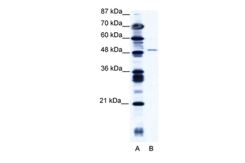 ZNF627 Rabbit Polyclonal Antibody