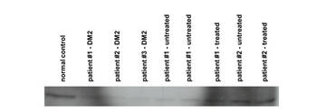 CNBP Rabbit Polyclonal Antibody