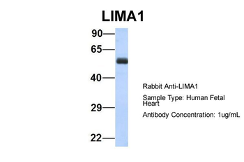 LIMA1 Rabbit Polyclonal Antibody