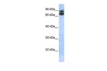 LIMA1 Rabbit Polyclonal Antibody