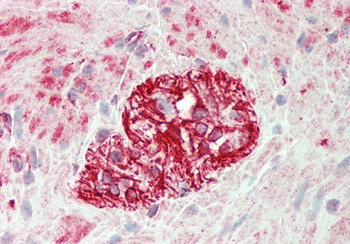 KLHL25 Rabbit Polyclonal Antibody