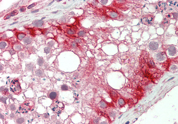 KLHL25 Rabbit Polyclonal Antibody