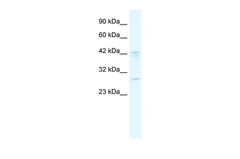 BRD9 Rabbit Polyclonal Antibody