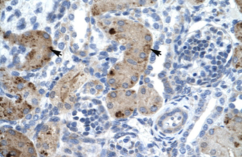 ZNF258 Rabbit Polyclonal Antibody