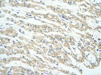PHF11 Rabbit Polyclonal Antibody