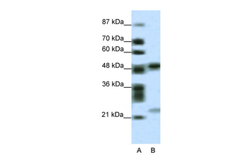 PHF11 Rabbit Polyclonal Antibody
