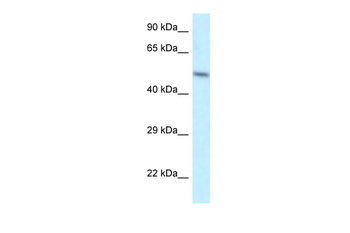 ZFP2 Rabbit Polyclonal Antibody