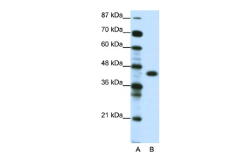 ZNF396 Rabbit Polyclonal Antibody