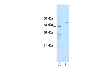 TRIM35 Rabbit Polyclonal Antibody