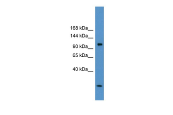 Clcn1 Rabbit Polyclonal Antibody