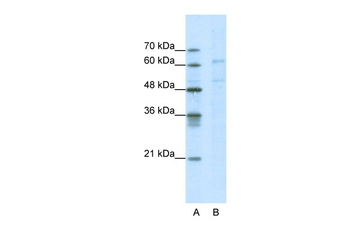 CACNB3 Rabbit Polyclonal Antibody