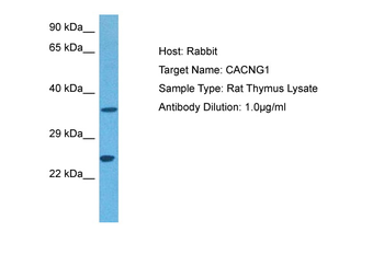 Cacng1 Rabbit Polyclonal Antibody