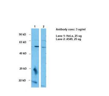GABRA3 Rabbit Polyclonal Antibody