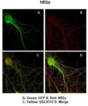 GRIN2A Rabbit Polyclonal Antibody
