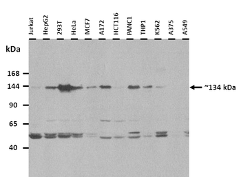 GRIN2C Rabbit Polyclonal Antibody