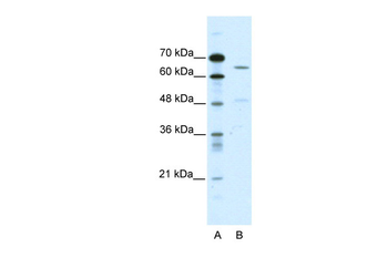 ACCN1 Rabbit Polyclonal Antibody