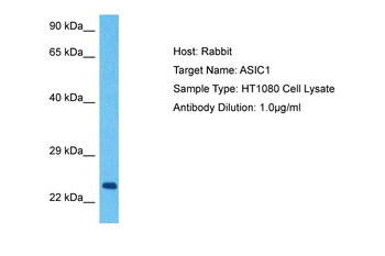 ASIC1 Rabbit Polyclonal Antibody