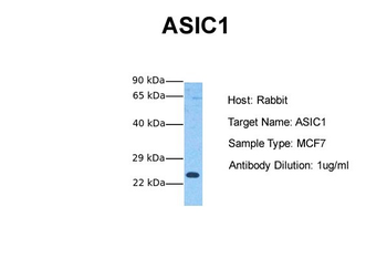ASIC1 Rabbit Polyclonal Antibody