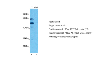 ASIC1 Rabbit Polyclonal Antibody