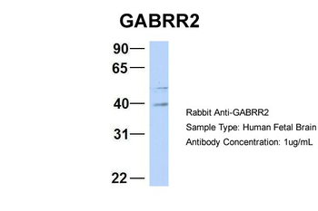 GABRR2 Rabbit Polyclonal Antibody