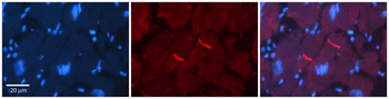 GABRR2 Rabbit Polyclonal Antibody