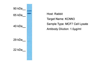 KCNN3 Rabbit Polyclonal Antibody