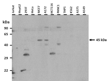 P2RX1 Rabbit Polyclonal Antibody