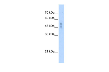 P2RX1 Rabbit Polyclonal Antibody
