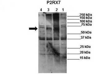 P2RX7 Rabbit Polyclonal Antibody