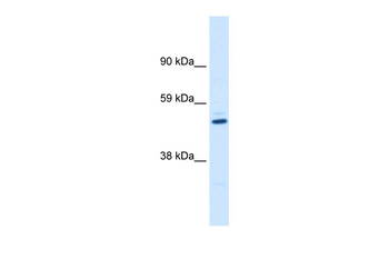 KCNAB1 Rabbit Polyclonal Antibody
