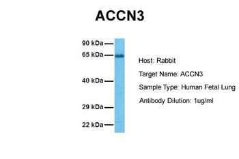 ACCN3 Rabbit Polyclonal Antibody