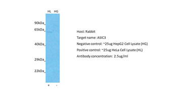 ACCN3 Rabbit Polyclonal Antibody