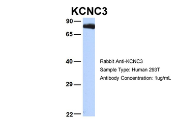 KCNC3 Rabbit Polyclonal Antibody