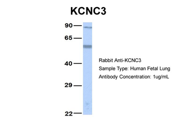 KCNC3 Rabbit Polyclonal Antibody