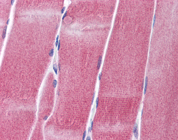 KCNC4 Rabbit Polyclonal Antibody